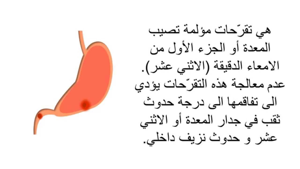 اعراض التهاب المعدة والاثنى عشر , قبل فوات الاوان هذه اعراض التهابات المعدة والاثنى عشر