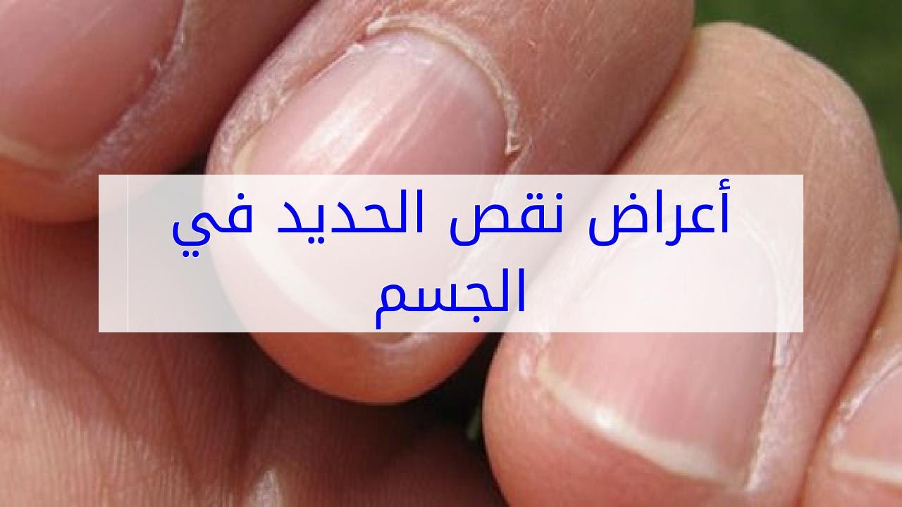 اعراض نقص الحديد , ازاي اعرف انه عندي نقص في الحديد