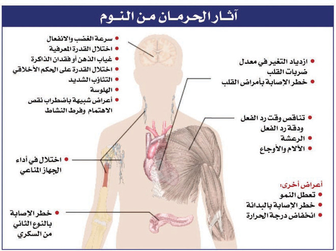 اثار قلة النوم - كوارث عدم النوم