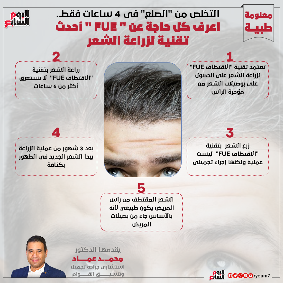 اسعار زراعة الشعر , كم يتكلف زراعه الشعر