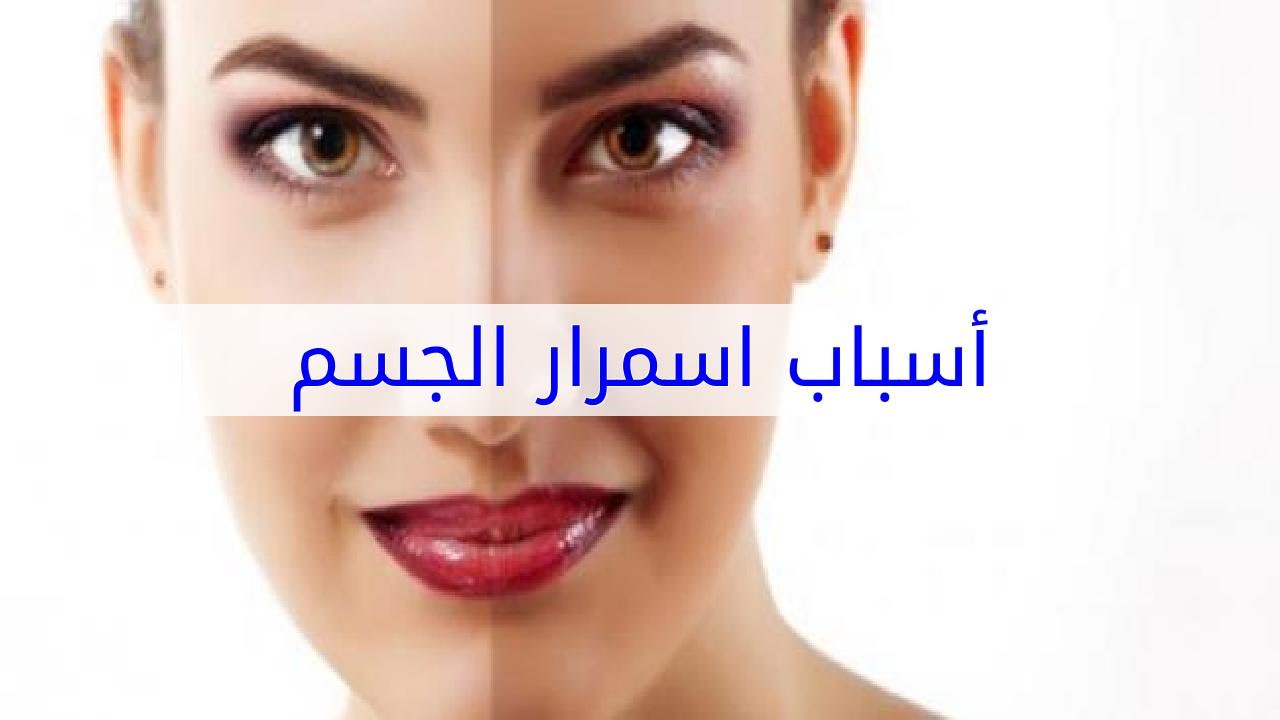 اسباب اسمرار الجسم , اكتشفي السر وراء الاسمرار المفاجئ