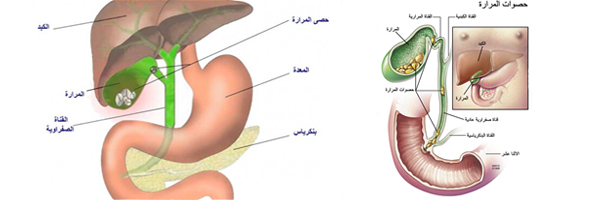 علاج انسداد القنوات المرارية